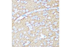 Immunohistochemistry of paraffin-embedded mouse brain using NC / CD56 Rabbit pAb (ABIN1679098, ABIN3015129 and ABIN7101312) at dilution of 1:100 (40x lens). (CD56 抗体)