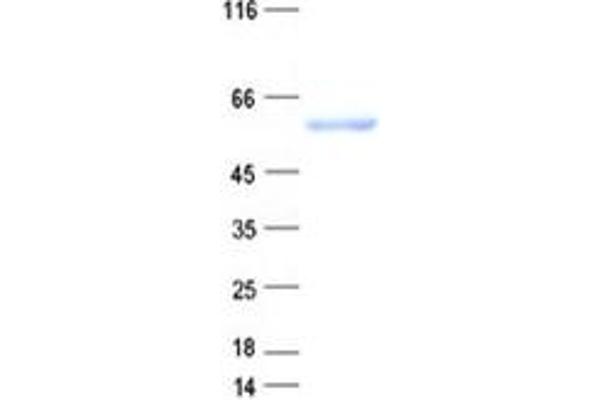 TBL1XR1 Protein (His tag)