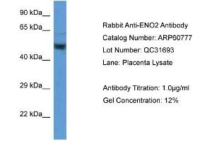 Western Blotting (WB) image for anti-Enolase 2 (Gamma, Neuronal) (ENO2) (Middle Region) antibody (ABIN786269) (ENO2/NSE 抗体  (Middle Region))