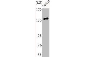 Western Blot analysis of Jurkat cells using N-cadherin Polyclonal Antibody (N-Cadherin 抗体  (C-Term))