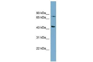 FZD6 antibody used at 1 ug/ml to detect target protein. (FZD6 抗体)