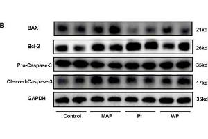 Western Blotting (WB) image for anti-B-Cell CLL/lymphoma 2 (BCL2) (N-Term) antibody (ABIN2857047)