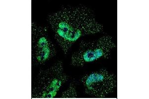 Confocal immunofluorescent analysis of ELAVL1 Antibody (ABIN659118 and ABIN2843759) with NCI- cell followed by Alexa Fluor® 488-conjugated goat anti-mouse lgG (green). (ELAVL1 抗体)