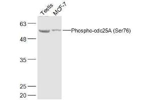 Lane 1: Mouse Testis lysates Lane 2: Human MCF-7 lysates probed with Phospho-cdc25A (Ser76) Polyclonal Antibody, Unconjugated  at 1:500 dilution and 4˚C overnight incubation. (CDC25A 抗体  (pSer76))