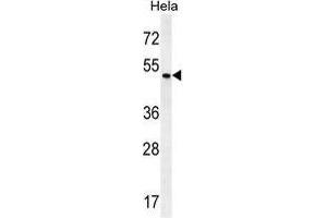 ZMYND17 Antibody (C-term) western blot analysis in Hela cell line lysates (35 µg/lane). (ZMYND17 抗体  (C-Term))