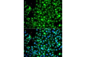 Immunofluorescence analysis of A549 cells using NME2 antibody. (NME2 抗体  (AA 1-152))