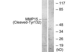 Western Blotting (WB) image for anti-Matrix Metallopeptidase 15 (Membrane-inserted) (MMP15) (Cleaved-Tyr132) antibody (ABIN1853595) (MMP15 抗体  (Cleaved-Tyr132))