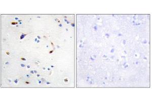 Immunohistochemistry (IHC) image for anti-Zinc Finger E-Box Binding Homeobox 2 (ZEB2) (N-Term) antibody (ABIN1848992) (ZEB2 抗体  (N-Term))