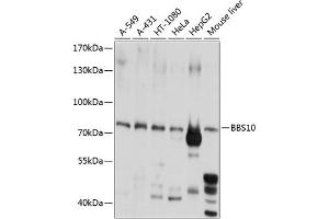 Western blot analysis of extracts of various cell lines, using BBS10 antibody  at 1:1000 dilution. (BBS10 抗体  (AA 474-723))