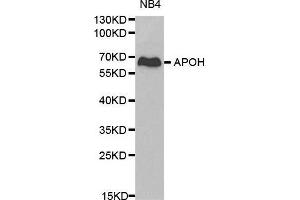 Western blot analysis of NB4 cell lysate using APOH antibody. (APOH 抗体  (AA 21-345))