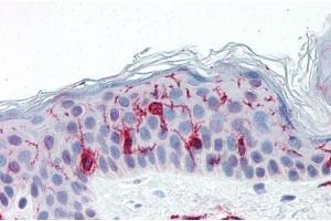 Human Skin: Formalin-Fixed, Paraffin-Embedded (FFPE) (MHC Class II DQ/DR 抗体 (FITC))