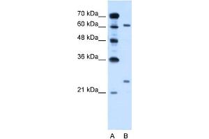 WB Suggested Anti-RORA Antibody Titration:  0. (RORA 抗体  (Middle Region))