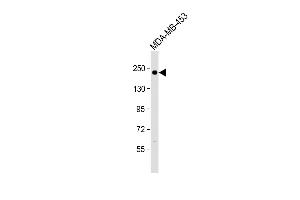 Anti ERBB2 Antibody  at 1:500 dilution + MDA-MB-453 whole cell lysate Lysates/proteins at 20 μg per lane. (ErbB2/Her2 抗体  (AA 706-735))