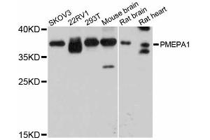 Western blot analysis of extracts of various cell lines, using PMEPA1 antibody. (PMEPA1 抗体)