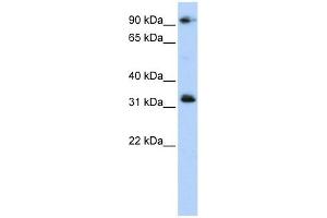 CCDC69 antibody used at 1 ug/ml to detect target protein. (CCDC69 抗体  (Middle Region))