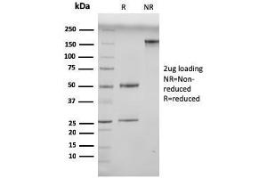 SDS-PAGE Analysis Purified N-Cadherin Mouse Monoclonal Antibody (13A9). (N-Cadherin 抗体  (Cytoplasmic Domain))