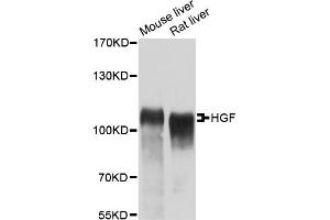 Western blot analysis of extracts of various cell lines, using HGF antibody (ABIN5970537) at 1:400 dilution. (HGF 抗体)