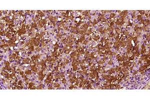 Paraformaldehyde-fixed, paraffin embedded rat ovary, Antigen retrieval by boiling in sodium citrate buffer (pH6) for 15min, Block endogenous peroxidase by 3% hydrogen peroxide for 30 minutes, Blocking buffer (normal goat serum) at 37°C for 20min, Antibody incubation with CCL26 Polyclonal Antibody  at 1:400 overnight at 4°C, followed by a SP kit and DAB staining. (CCL26 抗体  (AA 21-94))