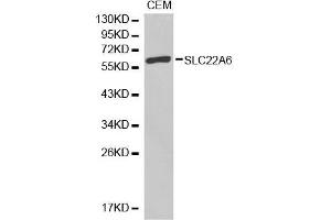 Western blot analysis of extracts of CEM cell lines, using SLC22A6 antibody. (SLC22A6 抗体)