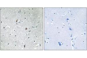 Immunohistochemistry (IHC) image for anti-Mechanistic Target of Rapamycin (serine/threonine Kinase) (mTOR) (pSer2448) antibody (ABIN2888475) (MTOR 抗体  (pSer2448))