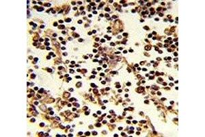IHC analysis of FFPE human lymph stained with CD19 antibody (CD19 抗体  (AA 143-172))