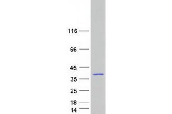 DNAJC8 Protein (Myc-DYKDDDDK Tag)