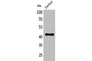 Western Blot analysis of Jurkat cells using BMP-8A Polyclonal Antibody (BMP8A 抗体  (Internal Region))