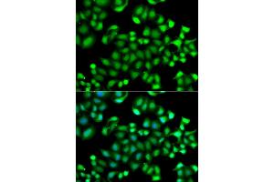 Immunofluorescence analysis of A549 cells using MAPKAPK3 antibody. (MAPKAP Kinase 3 抗体)