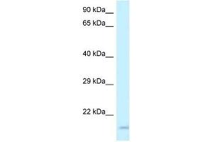 Western Blot showing GP9 antibody used at a concentration of 1 ug/ml against ACHN Cell Lysate (CD42a 抗体  (Middle Region))