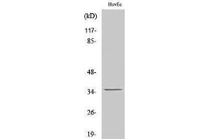 Western Blotting (WB) image for anti-Nanog Homeobox Pseudogene 8 (NANOGP8) (Internal Region) antibody (ABIN6283085) (NANOGP8 抗体  (Internal Region))