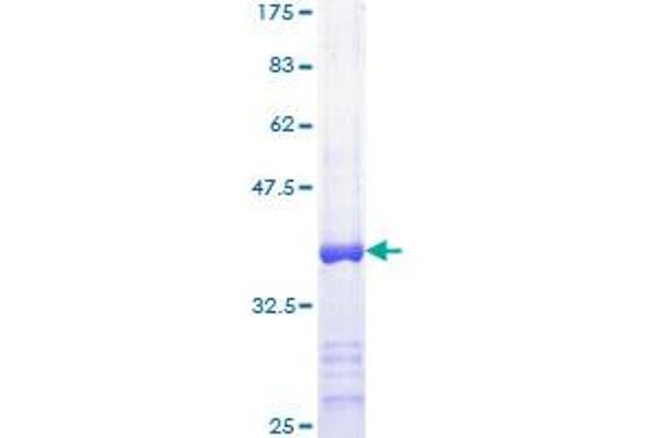 MAP3K14 Protein (AA 847-947) (GST tag)