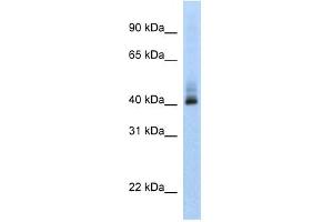 ANKRD42 antibody used at 1 ug/ml to detect target protein. (ANKRD42 抗体  (N-Term))