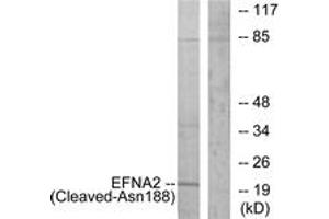 Western Blotting (WB) image for anti-Ephrin A2 (EFNA2) (AA 139-188), (Cleaved-Asn188) antibody (ABIN2891194) (Ephrin A2 抗体  (Cleaved-Asn188))