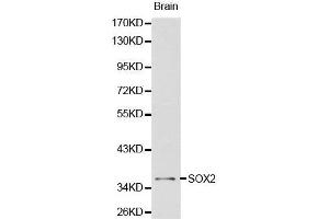 Western Blotting (WB) image for anti-SRY (Sex Determining Region Y)-Box 2 (SOX2) (AA 1-140) antibody (ABIN6213889) (SOX2 抗体  (AA 1-140))