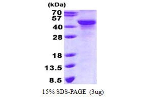 NDRG2 Protein (His tag)