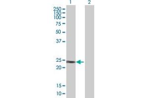 Western Blot analysis of HRAS expression in transfected 293T cell line by HRAS MaxPab polyclonal antibody. (HRAS 抗体  (AA 1-189))