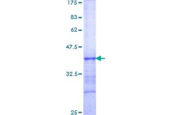 HLX Protein (AA 176-279) (GST tag)