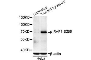 Western blot analysis of extracts of NIH/3T3 and HeLa cells, using Phospho-RAF1-S259 antibody (ABIN5996185) at 1/1000 dilution. (RAF1 抗体  (pSer259))