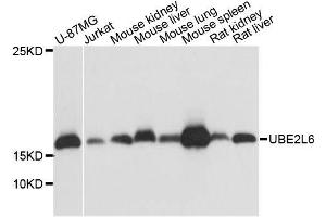 Western blot analysis of extracts of various cell lines, using UBE2L6 antibody. (UBE2L6 抗体  (C-Term))