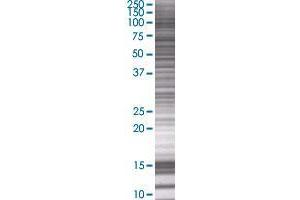 CXorf20 transfected lysate. (CXorf20 293T Cell Transient Overexpression Lysate(Denatured))