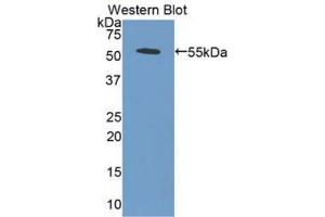 Western blot analysis of the recombinant protein. (BMP5 抗体  (AA 317-454))