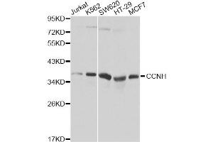 Western blot analysis of extracts of various cell lines, using CCNH Antibody (ABIN5970383). (Cyclin H 抗体)