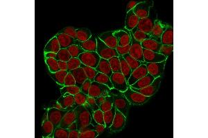 Immunofluorescence (IF) image for anti-Cadherin 1, Type 1, E-Cadherin (Epithelial) (CDH1) antibody (ABIN6941299)