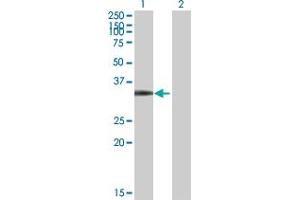 Western Blot analysis of CDK4 expression in transfected 293T cell line by CDK4 MaxPab polyclonal antibody. (CDK4 抗体  (AA 1-303))