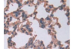 DAB staining on IHC-P; Samples: Rat Lung Tissue (LCNL1 抗体  (AA 2-164))