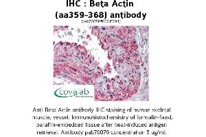 Image no. 1 for anti-Actin, beta (ACTB) (AA 359-368) antibody (ABIN1732309) (beta Actin 抗体  (AA 359-368))