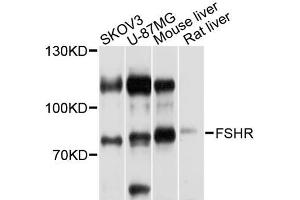 Western blot analysis of extracts of various cell lines, using FSHR antibody (ABIN5970692) at 1/1000 dilution. (FSHR 抗体)