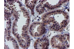 Immunohistochemistry (IHC) image for anti-Coiled-Coil-Helix-Coiled-Coil-Helix Domain Containing 5 (CHCHD5) (AA 1-110) antibody (ABIN1490561) (CHCHD5 抗体  (AA 1-110))