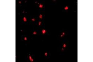 Immunofluorescence (IF) image for anti-Cas-Br-M (Murine) Ecotropic Retroviral Transforming Sequence (CBL) (C-Term) antibody (ABIN1030323) (CBL 抗体  (C-Term))