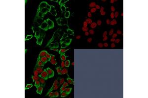 Immunofluorescence (IF) image for anti-Epithelial Cell Adhesion Molecule (EPCAM) antibody (ABIN6939981)